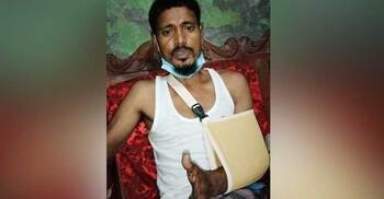 পিটিয়ে ইজিবাইক চালকের হাত ভাঙার অভিযোগ চৌকিদারের বিরুদ্ধে