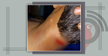 পটুয়াখালীতে আ’লীগ-স্বতন্ত্র প্রার্থীর সমর্থকদের সংঘর্ষ, আহত ১০