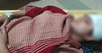 মাদক ব্যবসায়ীর বিরুদ্ধে দুপুরে জিডি, রাতে পরিবারসহ কুপিয়ে জখম