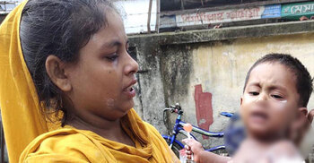 চুলায় থাকা গরম ডালে পড়ে প্রাণ গেলো শিশুর