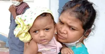 This 4-month-old spent 18 days on ventilator, beat Covid-19