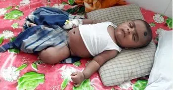 2.5-month-old Tamim recovers from Covid-19