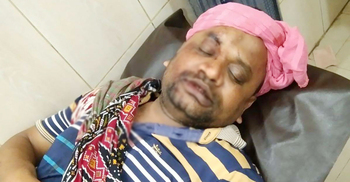 গাজীপুরে কিশোর গ্যাংয়ের তাণ্ডব, বাড়ির মালিককে কুপিয়ে জখম