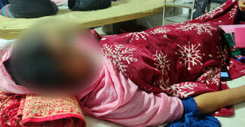 যৌতুক না পেয়ে গৃহবধূকে নির্যাতন, শরীরে জখমের চিহ্ন