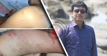 ১৬ শিক্ষার্থীকে পাইপ দিয়ে পিটিয়ে আটক কলেজের অধ্যক্ষ