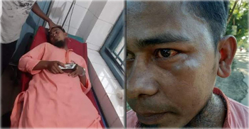 ভোলায় সাংবাদিকের ওপর সন্ত্রাসী হামলা