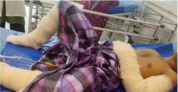 5 burnt in Narayanganj fire caused by gas leak
