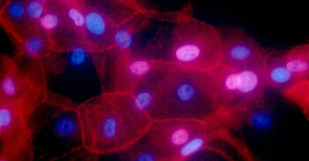 Some cancer patients can skip treatments, 2 studies show