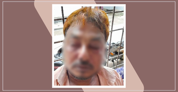 জমি বিরোধে চাবি দিয়ে চোখ জখম, কাটা হলো কান