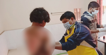 আগুন পোহাতে গিয়ে শিশুটির ৪০ শতাংশ পুড়ে গেল