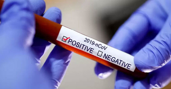 নোয়াখালীতে করোনা শনাক্ত ১৭ হাজার ছাড়াল