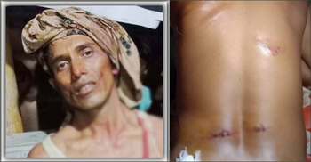 মহেশখালীতে আ’লীগের সম্মেলনে গোলাগুলি, আহত ১০