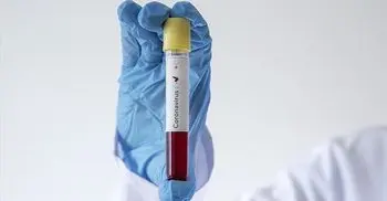 Saudi Arabia announces first case of coronavirus