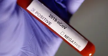 7 test positive for coronavirus in a day in Ctg