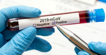 এক দিনেই সাংবাদিক বিচারকসহ ১১৭ করোনা আক্রান্ত