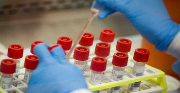 নাটোরে আরও এক স্বাস্থ্যকর্মী করোনায় আক্রান্ত