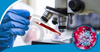 Sharp rise in Covid-19 cases in 24 hrs