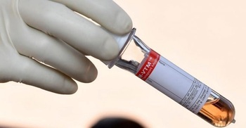 Oxford scientists develop five-minute Covid-19 antigen test