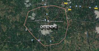 ভাতিজিকে উত্ত্যক্তের প্রতিবাদ করায় ঝলসে দেয়া হলো চাচার মুখ