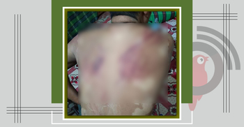 মোবাইল চুরির অভিযোগে যুবককে মারধর