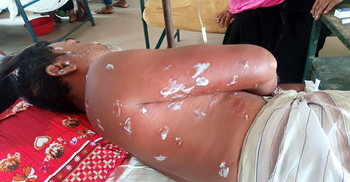 চাক ভাঙতে গিয়ে ভীমরুলের কামড়ে ব্যবসায়ীর মৃত্যু