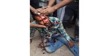 Dhaka City polls: 3 journalists injured in attacks