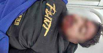 ফরিদপুরে ট্রাকের ধাক্কায় মাছ ব্যবসায়ী নিহত