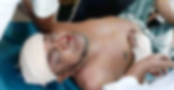 ছাগলনাইয়ায় মোটরসাইকেলের ধাক্কায় সাবেক মেম্বারের মৃত্যু