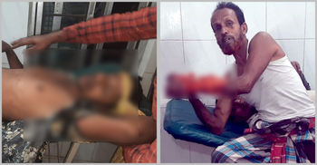 মুন্সিগঞ্জে প্রতিপক্ষের হামলায় দুজন গুলিবিদ্ধ