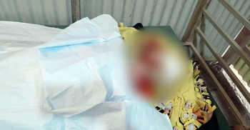 রোহিঙ্গা ক্যাম্পে গুলিতে নারী নিহত, হাসপাতালে হেড মাঝি