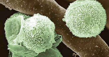 ব্ল্যাক-হোয়াইট-ইয়েলোর পর নতুন আতঙ্ক গ্রিন ফাঙ্গাস