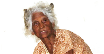 তিন বছর হাসপাতালে বৃদ্ধা, মৃত্যুর পর খোঁজ মিলল স্বজনদের