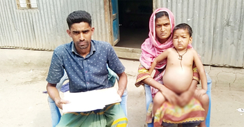 শিশু হাসানের কিডনির ছাঁকনিতে ছিদ্র, দিন দিন বড় হয়ে যাচ্ছে পেট