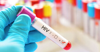 ‘Bangladesh at high risk of HIV infection’