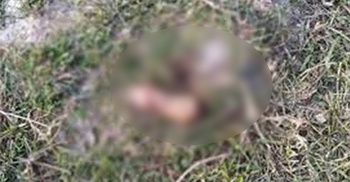 হবিগঞ্জে শিশুর খণ্ডিত হাত-মাথার খুলি উদ্ধার