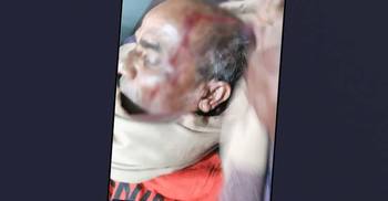 ছাত্রলীগ নেতার নেতৃত্বে একই পরিবারের ৫ জনকে কুপিয়ে হত্যাচেষ্টা