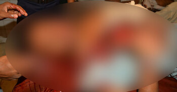 যশোরে ছাত্রদল নেতাকে কুপিয়ে জখম