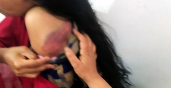 যবিপ্রবিতে গৃহকর্মীকে পিটিয়ে জখম করলেন ব্যাংক কর্মকর্তা