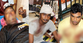 আধিপত্য বিস্তার নিয়ে শিশু উন্নয়ন কেন্দ্রে সংঘর্ষ, আহত ৩