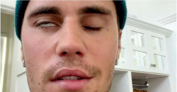 Justin Bieber reveals facial paralysis after shows cancelled