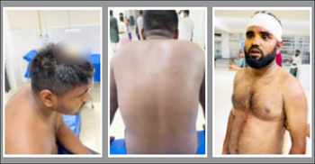 বোনকে উত্ত্যক্তের বিচার চাওয়ায় তিন ভাইকে কুপিয়ে জখম