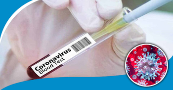 জয়পুরহাটে শিক্ষা কর্মকর্তাসহ আরও ৮৯ জন করোনায় আক্রান্ত