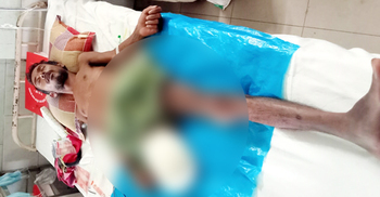 যুবদল নেতার মারপিটে পা হারালেন মানসিক প্রতিবন্ধী যুবক