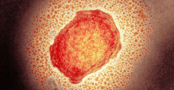 Monkeypox to get a new name, says WHO