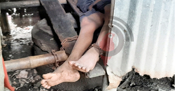 পরিত্যক্ত টয়লেটে ২০ বছর ধরে শিকলবন্দি শংকরী