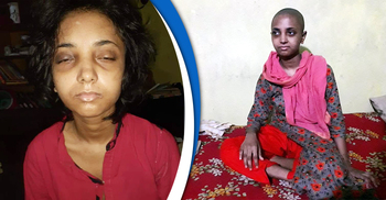 শিক্ষিকা সৎমায়ের নির্যাতনে তিথি এখন পাগলপ্রায়