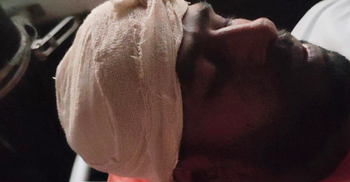 পিরোজপুরে আওয়ামী লীগের সম্মেলনে গুলি-সংঘর্ষ আহত ১৫