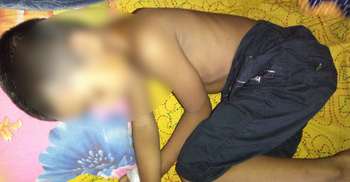 ঘুম ভেঙে যাওয়ায় শিশুর মাথায় ফুটন্ত ডাল ঢেলে দিলেন চাচা