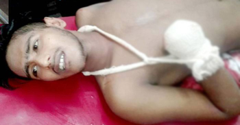 কলেজছাত্রের কব্জি কেটে নিল সন্ত্রাসীরা
