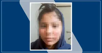 যৌতুক না দেয়ায় স্ত্রীর চুল-ভ্রু কেটে মুখ পুড়িয়ে দিলেন স্বামী